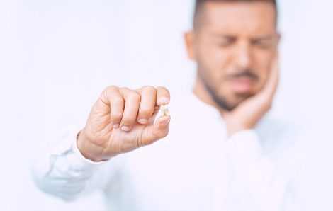 Things to Know about Wisdom Teeth Extraction